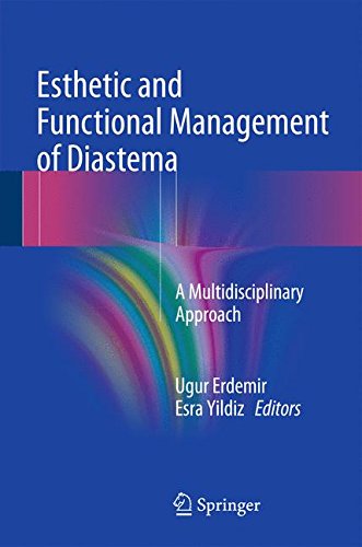 Esthetic and Functional Management of Diastema: A Multidisciplinary Approach