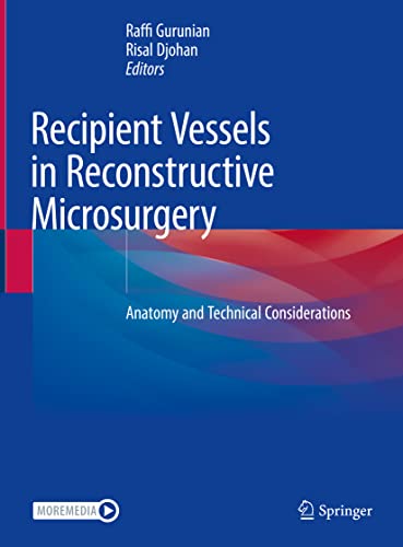 Recipient Vessels in Reconstructive Microsurgery: Anatomy and Technical Considerations