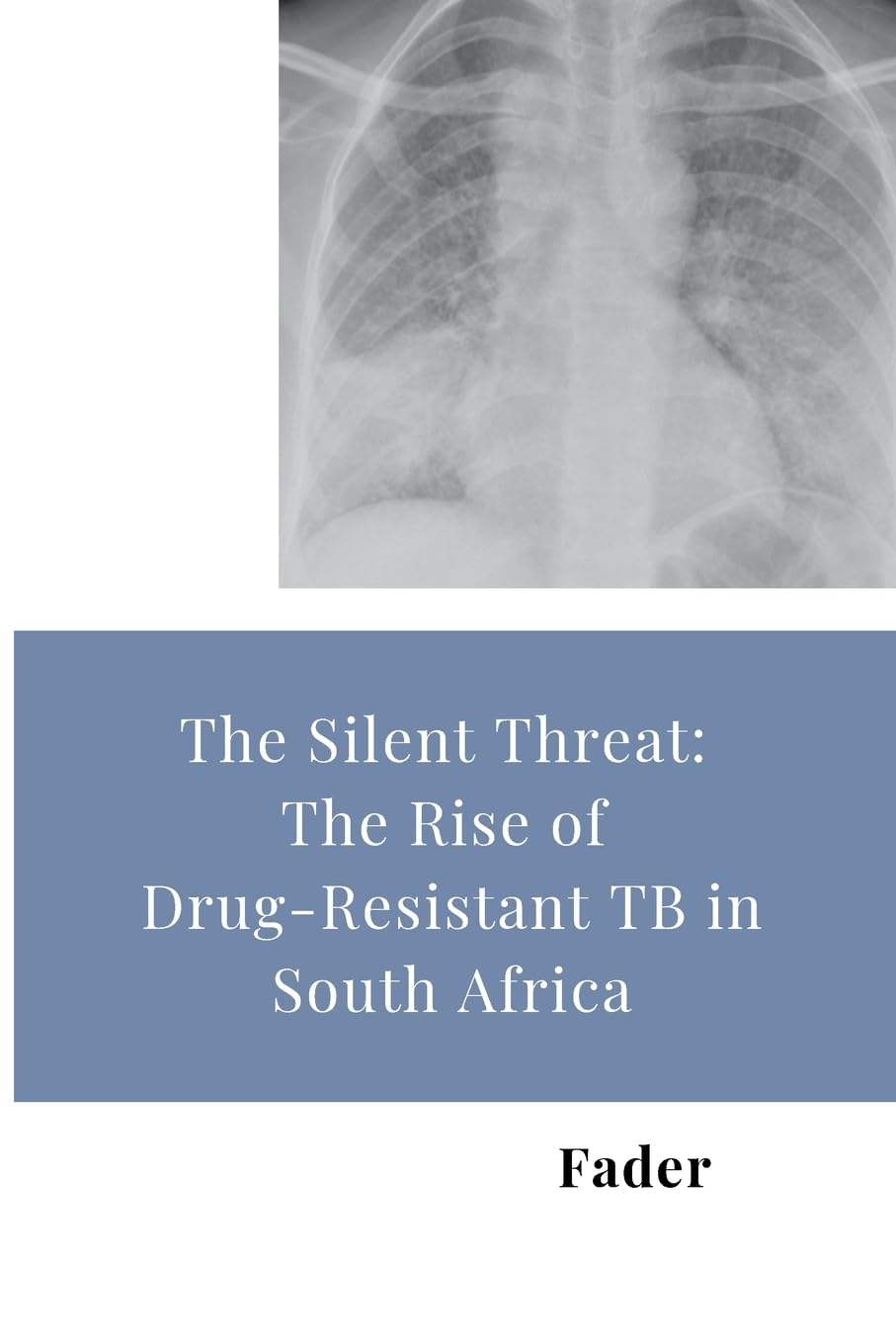 The Silent Threat: The Rise of Drug-Resistant TB in South Africa: DE