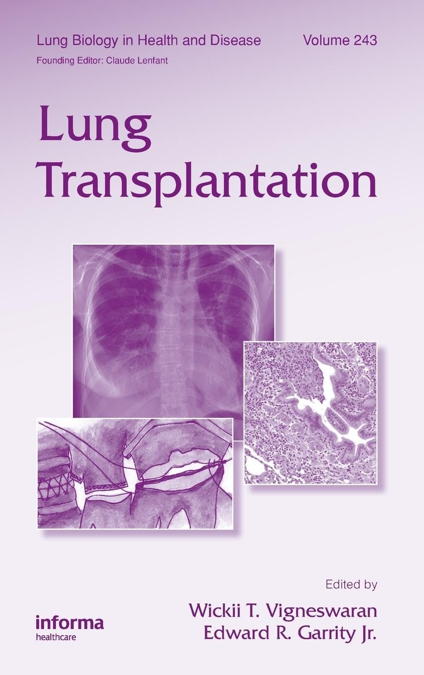 unbekannt Lung Transplantation (Lung Biology In Health And Disease, Band 243)