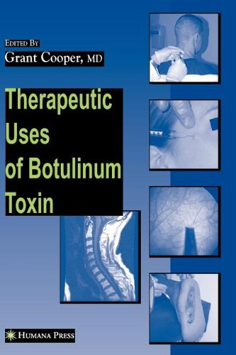 Therapeutic Uses of Botulinum Toxin (Musculoskeletal Medicine)