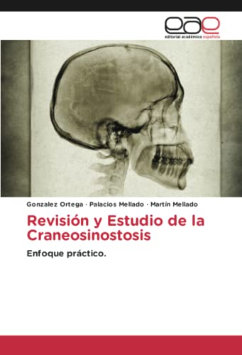 Revisión y Estudio de la Craneosinostosis: Enfoque práctico.