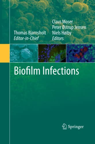 Biofilm Infections