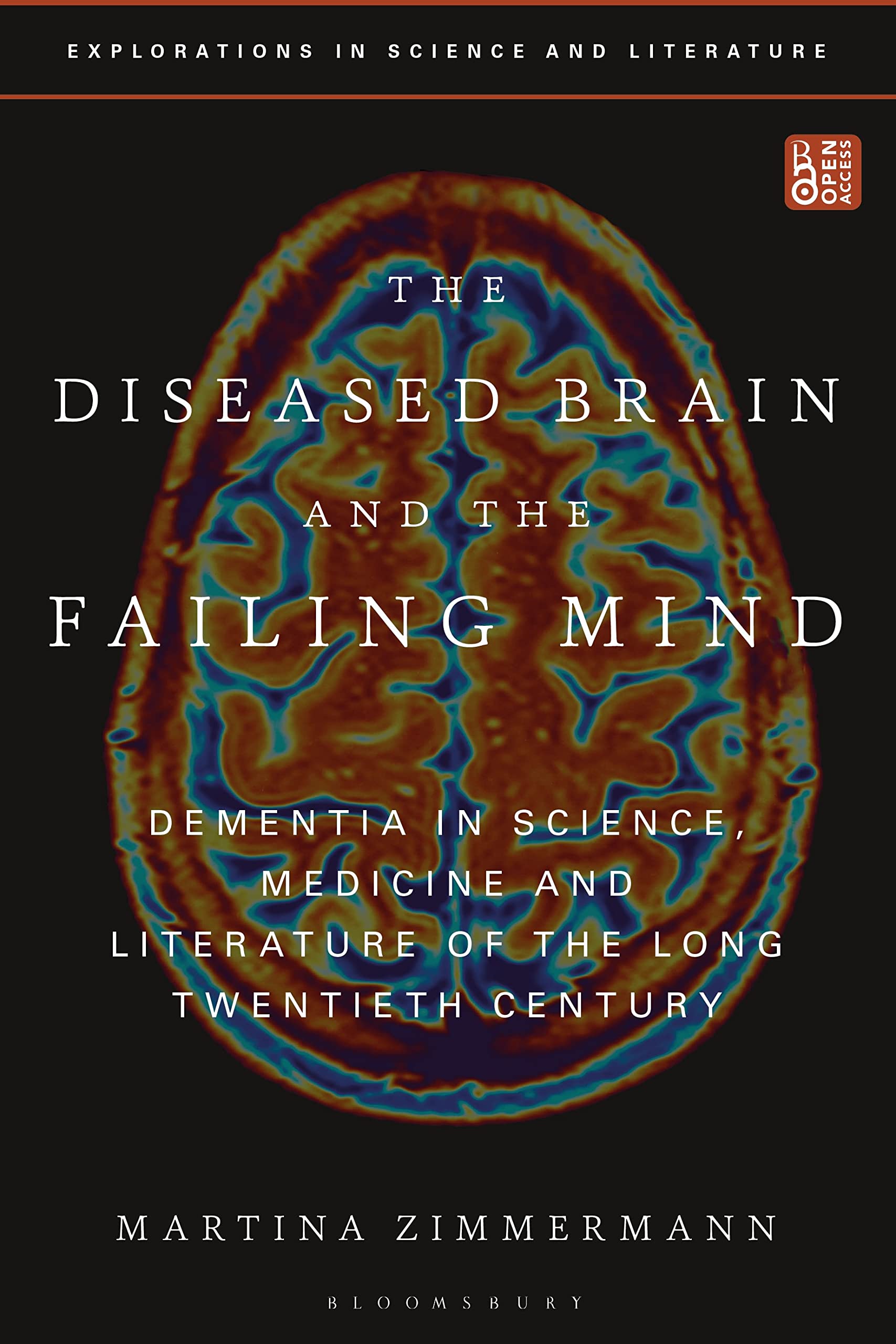 Diseased Brain and the Failing Mind, The: Dementia in Science, Medicine and Literature of the Long Twentieth Century (Explorations in Science and Literature)