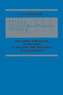 Electrical Stimulation of the Heart in the Study and Treatment of Tachycardias