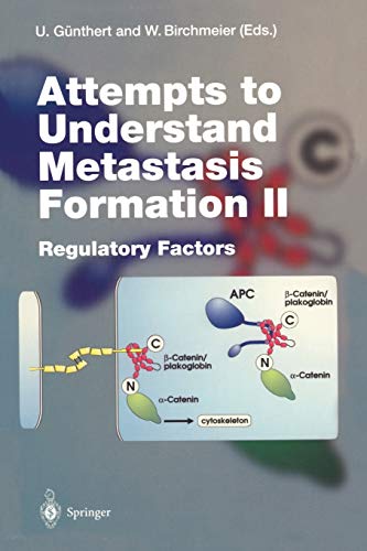 Attempts to Understand Metastasis Formation II: Regulatory Factors (Current Topics in Microbiology and Immunology) (Current Topics in Microbiology and Immunology, 213/2)