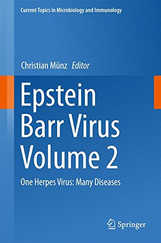Epstein Barr Virus Volume 2: One Herpes Virus: Many Diseases (Current Topics in Microbiology and Immunology)
