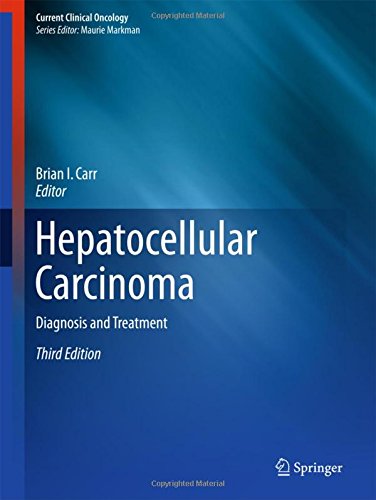 Hepatocellular Carcinoma: Diagnosis and Treatment (Current Clinical Oncology)