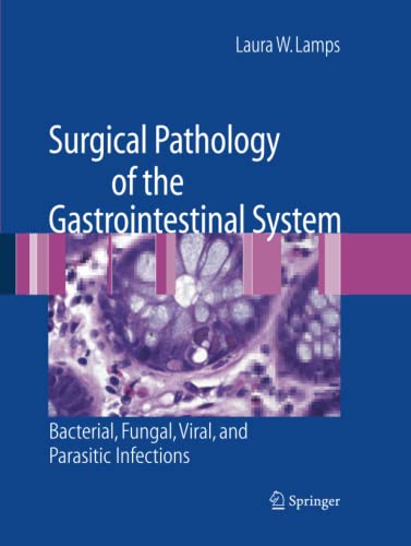 Surgical Pathology of the Gastrointestinal System: Bacterial, Fungal, Viral, and Parasitic Infections