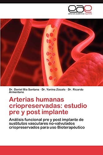 Arterias humanas criopreservadas: estudio pre y post implante: Análisis funcional pre y post implante de sustitutos vasculares no-valvulados criopreservados para uso Bioterapéutico