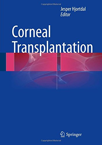 Corneal Transplantation