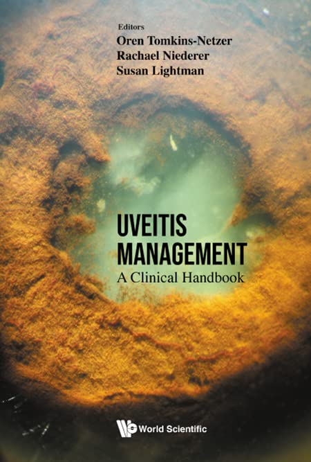 Uveitis Management: A Clinical Handbook