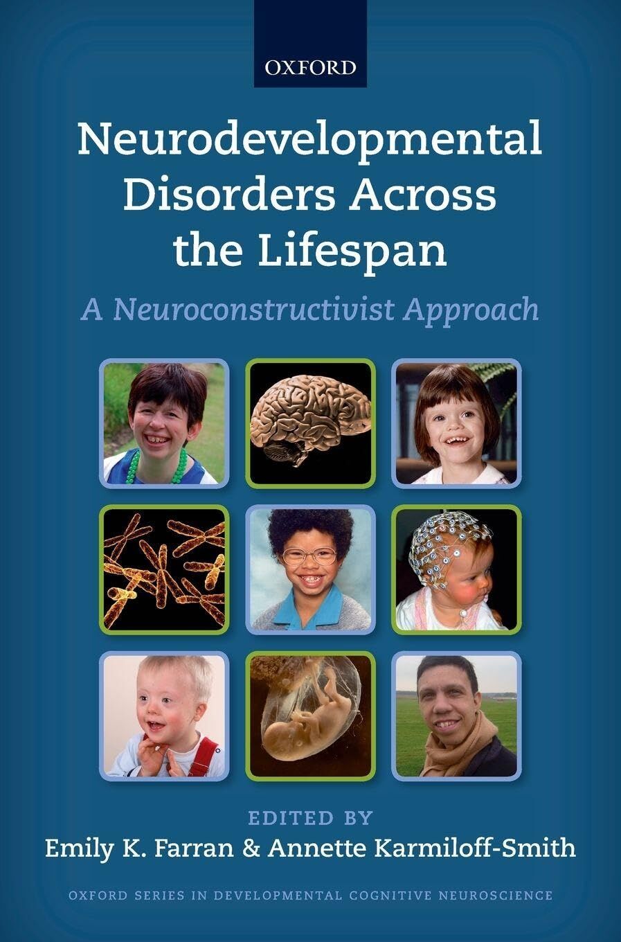 NEURODE DISORD ACROSS LIFESPAN DCN