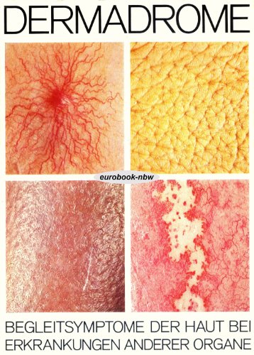 Dermadrome - Begleitsymptome der Haut bei Erkrankungen anderer Organe