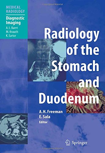 Radiology of the Stomach and Duodenum (Medical Radiology)