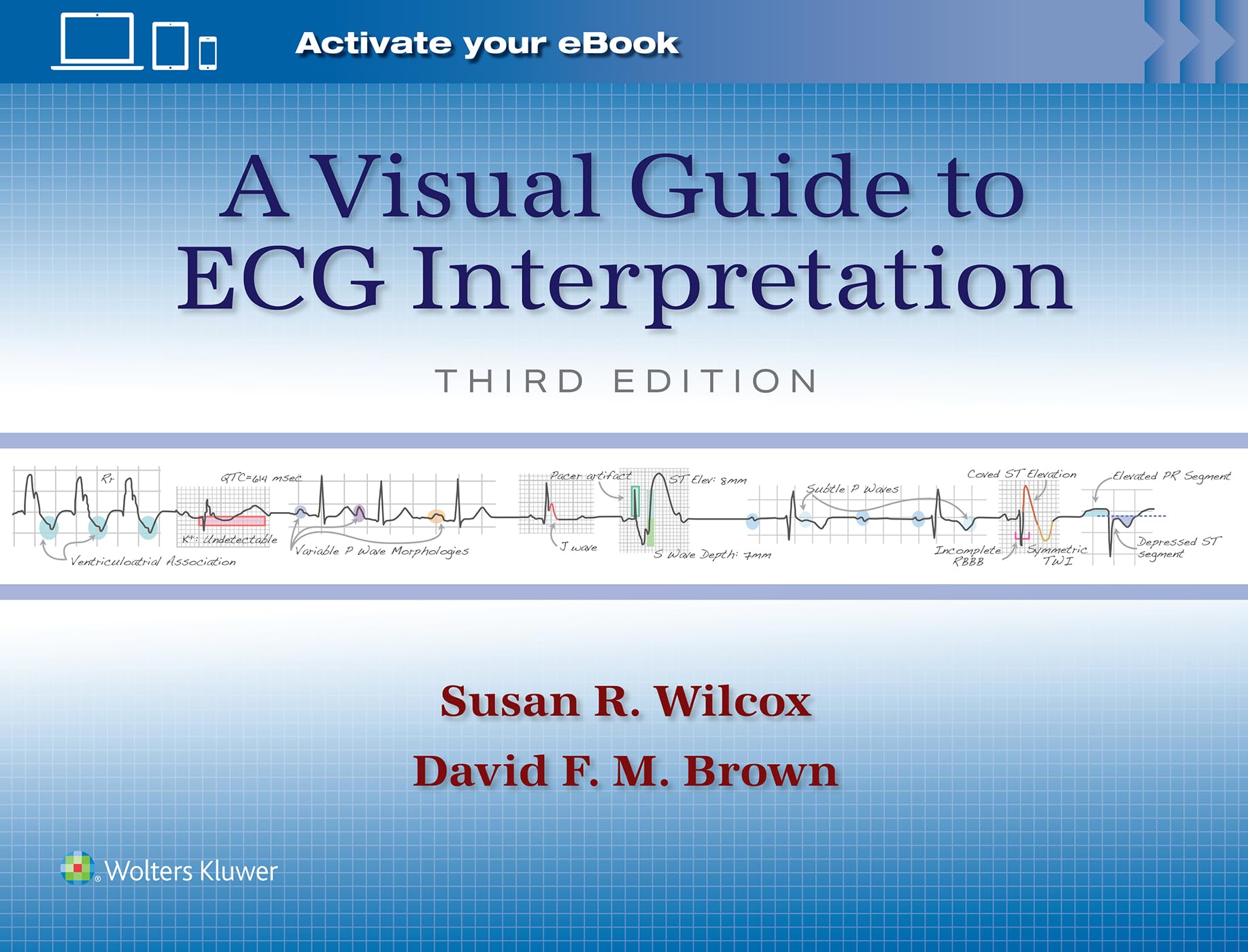 A Visual Guide to ECG Interpretation: Print + eBook with Multimedia - Neuware