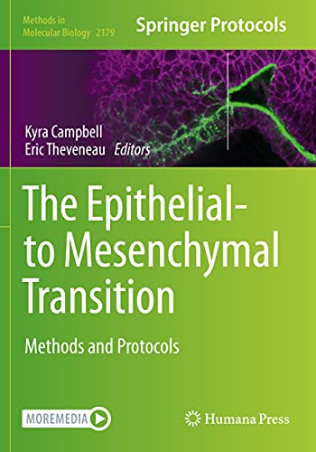 The Epithelial-to Mesenchymal Transition: Methods and Protocols (Methods in Molecular Biology, Band 2179)