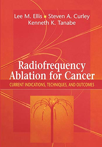 Radiofrequency Ablation for Cancer: Current Indications, Techniques, And Outcomes