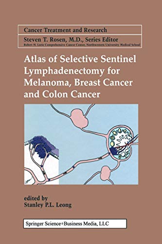Atlas of Selective Sentinel Lymphadenectomy for Melanoma, Breast Cancer and Colon Cancer (Cancer Treatment and Research, Band 111)
