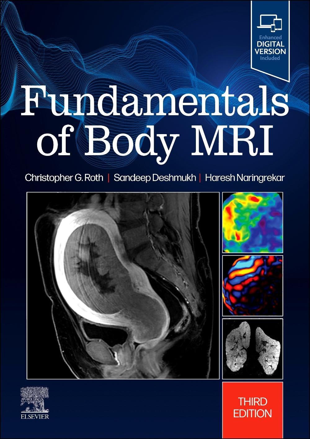 Roth Md, Christopher G. Fundamentals Of Body Mri (Fundamentals Of Radiology)