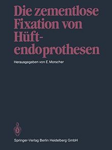 Die zementlose Fixation von Hüftendoprothesen (German Edition)