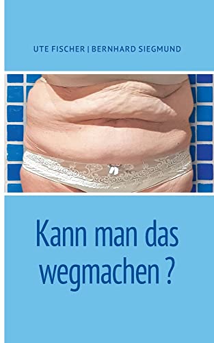 Kann man das wegmachen: DE