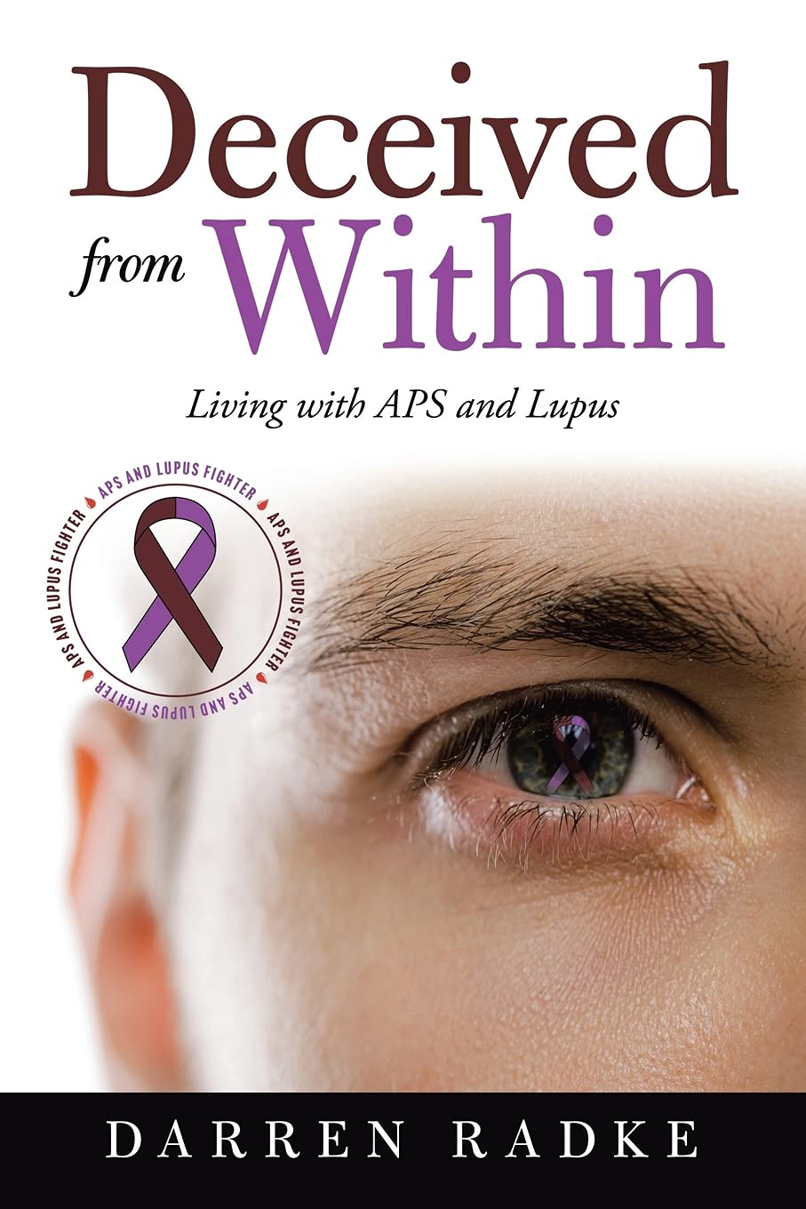 Deceived from Within: Living with APS and Lupus