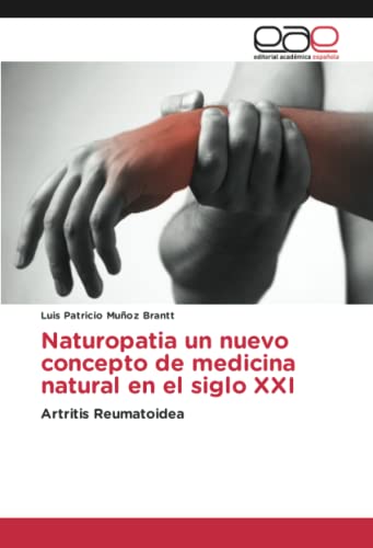 Naturopatia un nuevo concepto de medicina natural en el siglo XXI: Artritis Reumatoidea