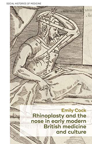 Rhinoplasty and the nose in early modern British medicine and culture (Social Histories of Medicine)