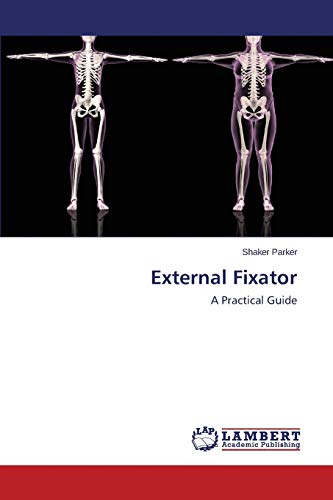 External Fixator: A Practical Guide