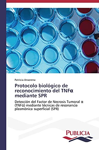 Protocolo biológico de reconocimiento del TNFα mediante SPR: Detección del Factor de Necrosis Tumoral α (TNFα) mediante técnicas de resonancia ... de resonancia plasmónica superficial (SPR)