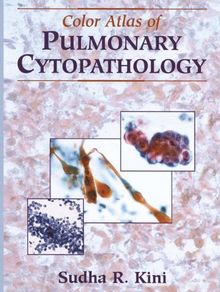 Color Atlas of Pulmonary Cytopathology