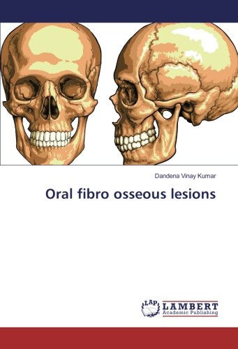 Oral fibro osseous lesions