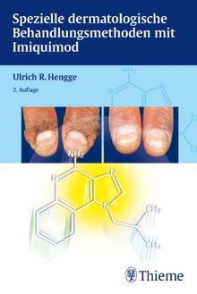 Spezielle dermatologische Behandlungsmethoden mit Imiquimod