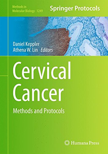 Cervical Cancer: Methods and Protocols (Methods in Molecular Biology)