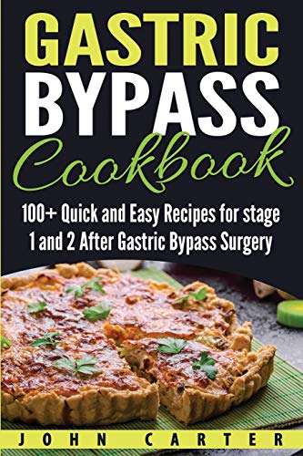 John Carter Gastric Bypass Cookbook, 100+ Quick And Easy Recipes For Stage 1 And 2 After Gastric Bypass Surgery (Bariatric Cookbook, Band 1)