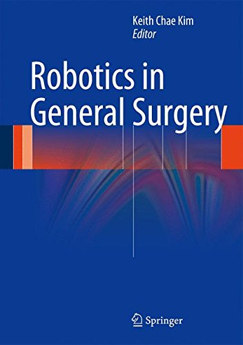 Robotics in General Surgery