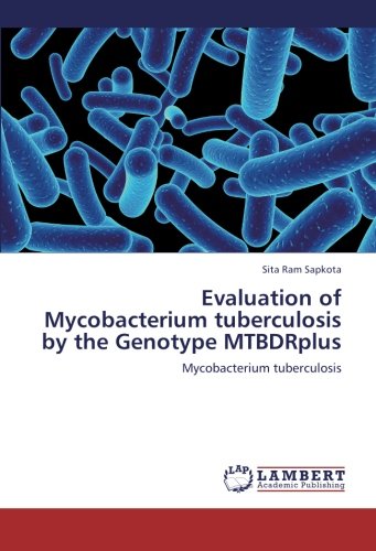 Evaluation of Mycobacterium tuberculosis by the Genotype MTBDRplus: Mycobacterium tuberculosis