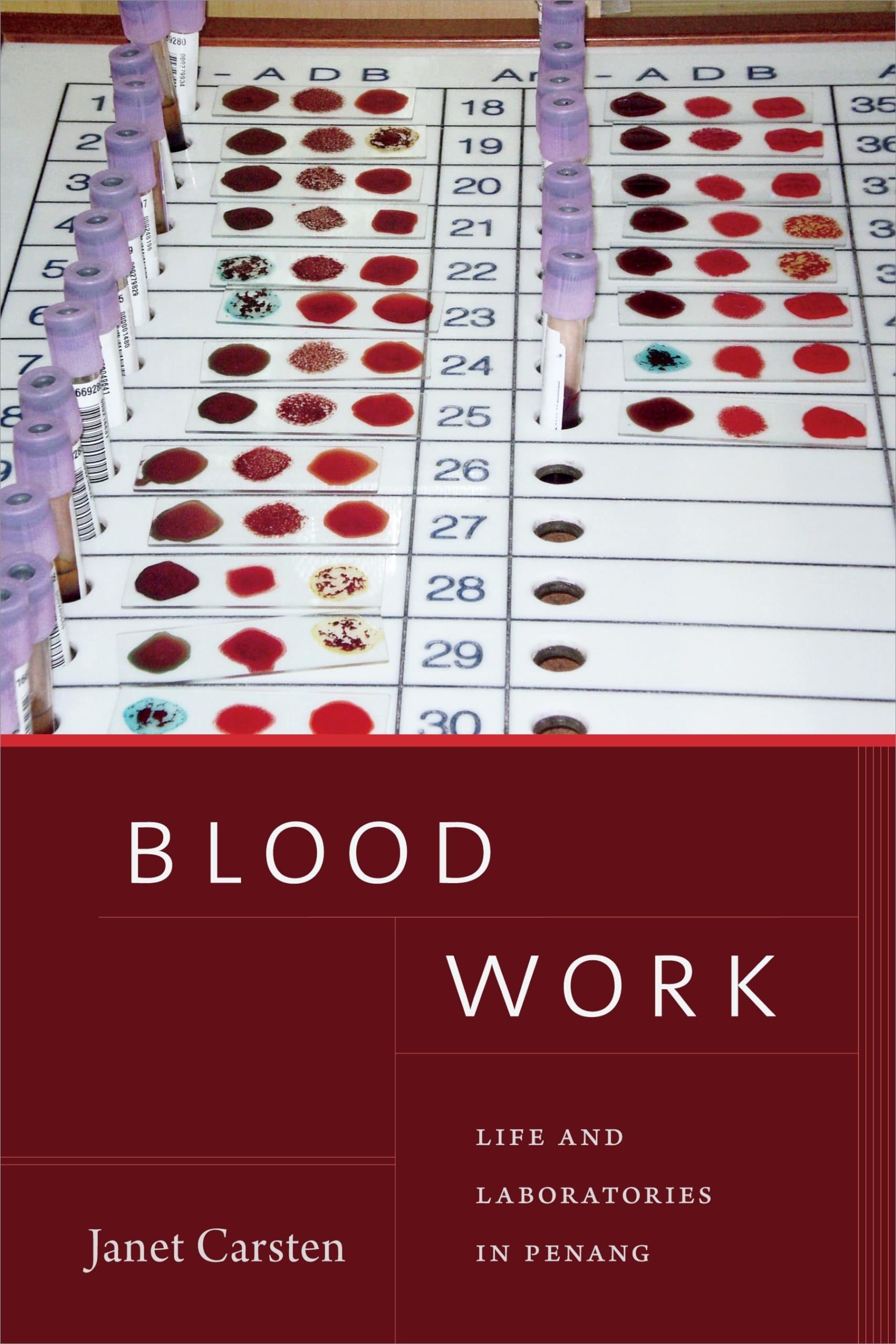 Blood Work: Life and Laboratories in Penang (Lewis Henry Morgan Lectures)