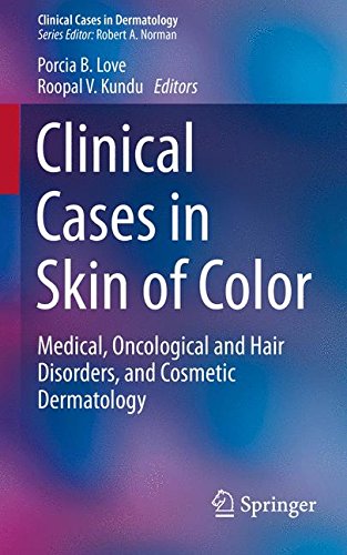 Clinical Cases in Skin of Color: Medical, Oncological and Hair Disorders, and Cosmetic Dermatology (Clinical Cases in Dermatology)