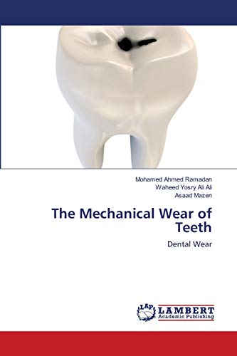 The Mechanical Wear of Teeth: Dental Wear