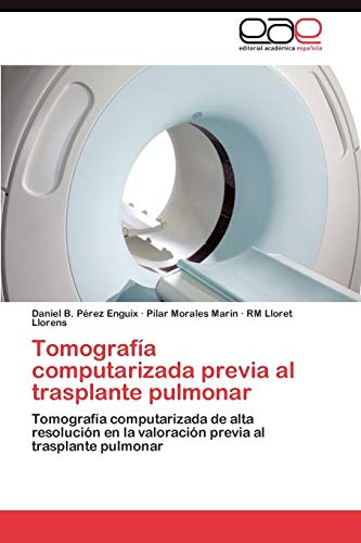 Tomografía computarizada previa al trasplante pulmonar: Tomografía computarizada de alta resolución en la valoración previa al trasplante pulmonar