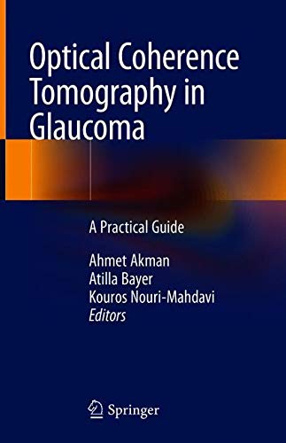 Optical Coherence Tomography in Glaucoma: A Practical Guide