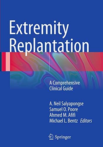 Extremity Replantation: A Comprehensive Clinical Guide
