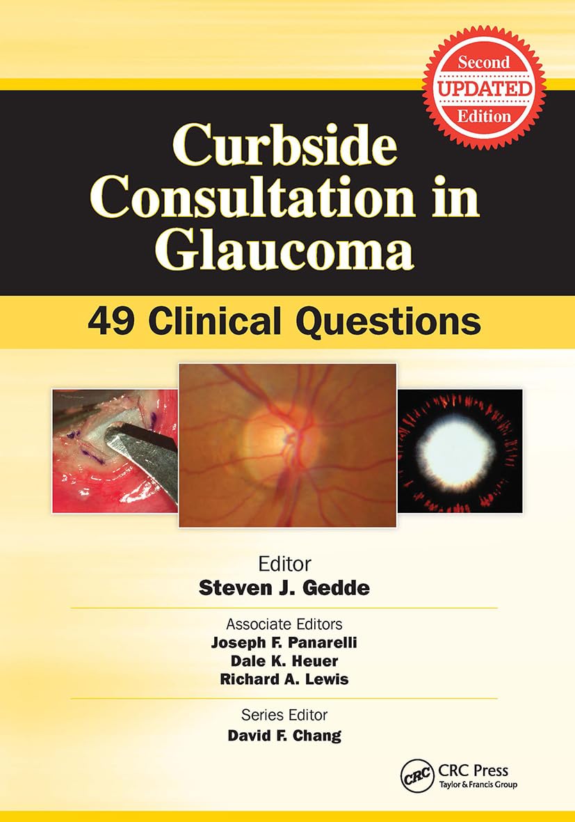 Curbside Consultation in Glaucoma: 49 Clinical Questions (Curbside Consultation in Opthalmology)