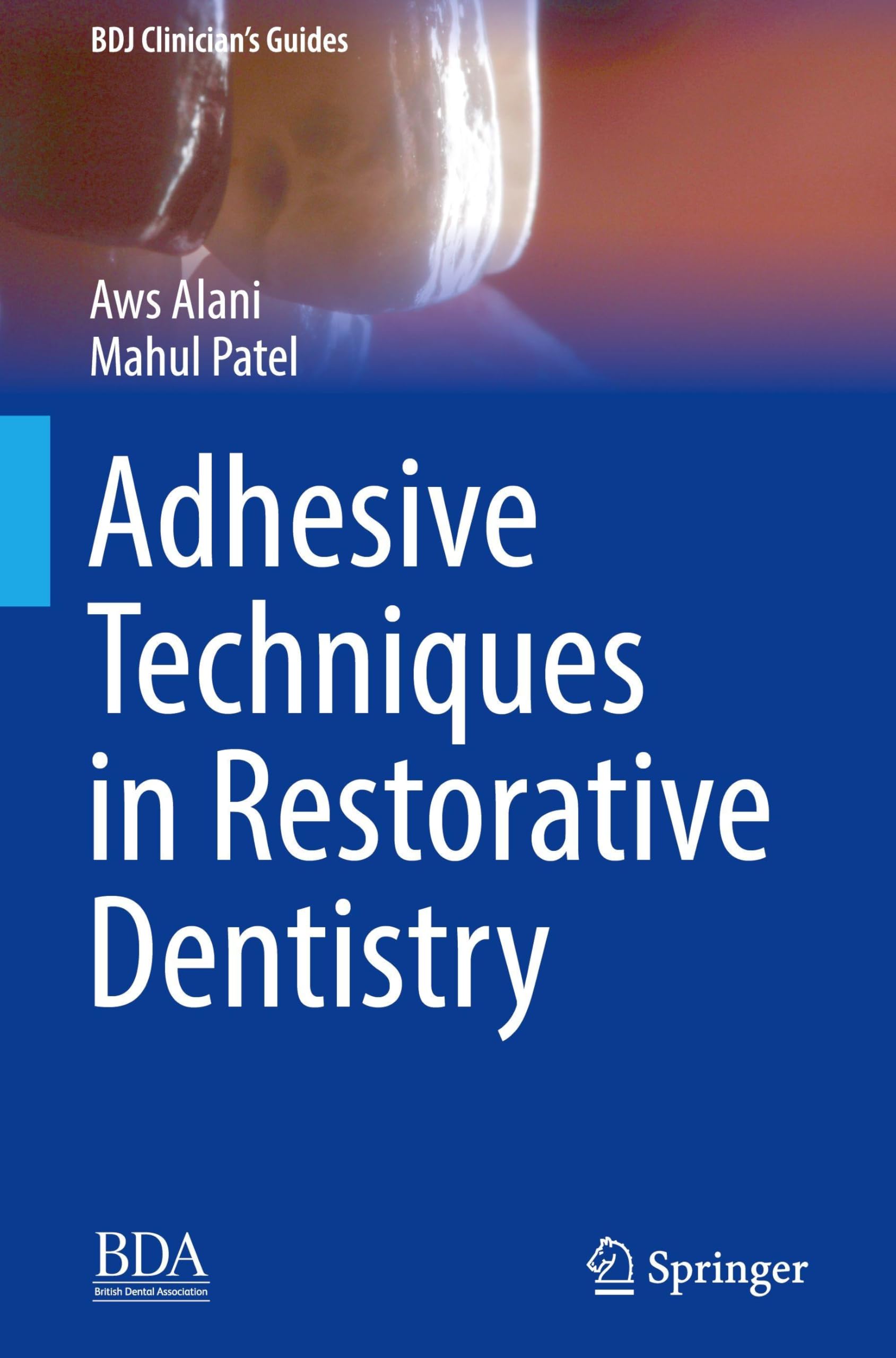 Adhesive Techniques in Restorative Dentistry (BDJ Clinician’s Guides)