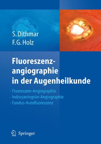 Fluoreszenzangiographie in der Augenheilkunde: Fluoreszein-Angiographie, Indozyaningrün-Angiographie und Fundus-Autofluoreszenz: ... Und Fundus-autofluoreszenz