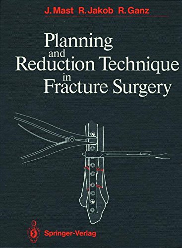 Planning and Reduction Technique in Fracture Surgery