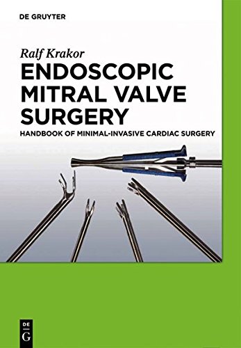 Endoscopic Mitral Valve Surgery: Handbook of Minimal-invasive Cardiac Surgery