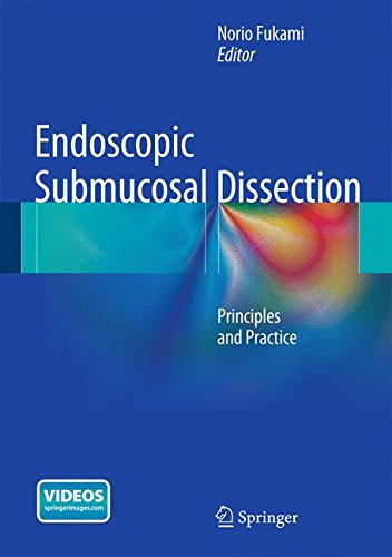 Endoscopic Submucosal Dissection: Principles and Practice